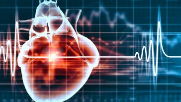 Detecting Risk of Heart Attack Using AI